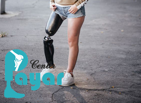 قیمت پنجه پای مصنوعی بیشتر است یا قیمت ساخت پروتز پا بالای زانو؟