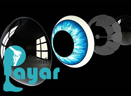 عوامل موثر روی قیمت پروتز چشم