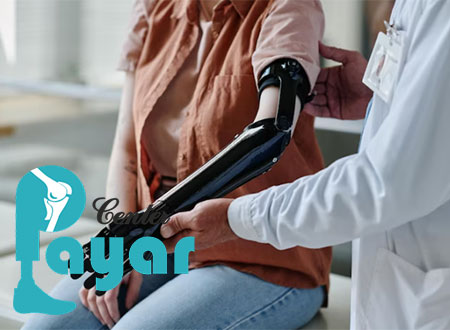 آشنایی با ساخت پروتز آرنج
