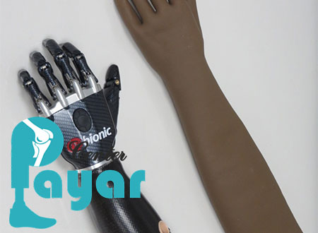 پروتز آرنج دست، کدام یک از انواع پروتز مصنوعی به شمار می رود؟