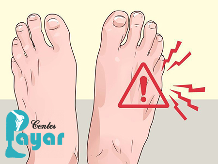 آیا میدانید چه زمانی پای دیابتی قطع می شود؟
