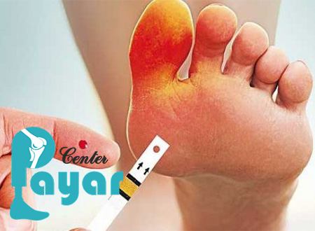 چه زمانی پای دیابتی قطع می شود و چند راهکار موثر برای جلوگیری از قطع پای دیابتی ها؟