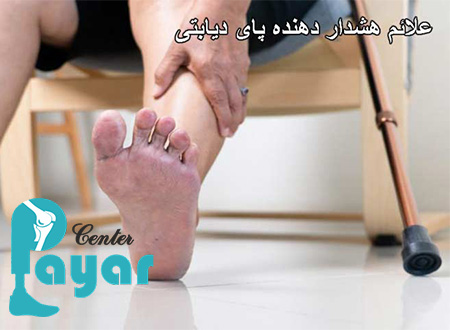 چه زمانی پای دیابتی قطع می شود