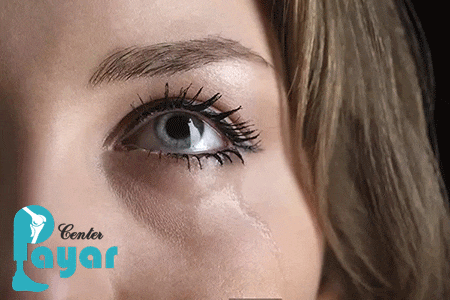 پیشگیری از علت آبریزش چشم در بزرگسالان