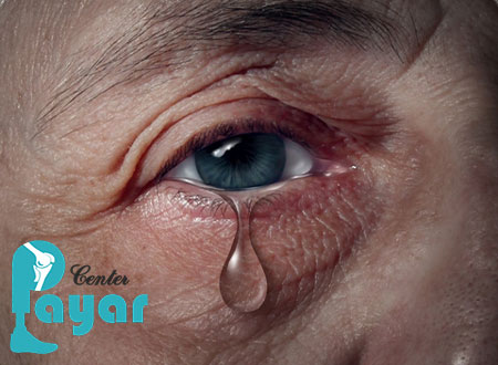 علت آبریزش چشم در طب سنتی چیست؟
