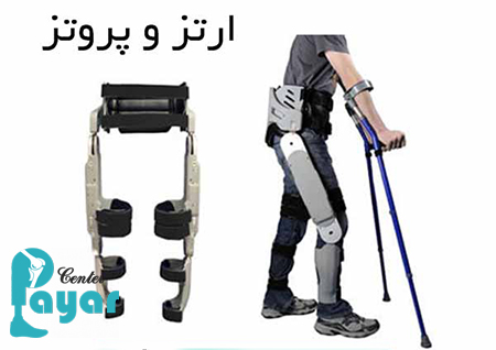 آیا میدانید تفاوت ارتز و پروتز چیست؟