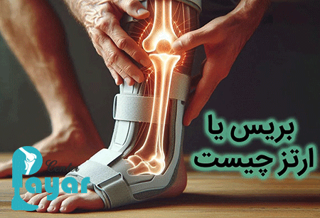 اهداف نصب ارتز چیست