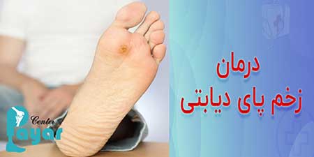 بهترین پماد برای درمان زخم پای دیابتی چیست؟ چه نام دارد