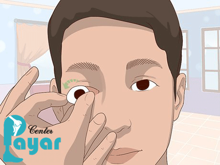 از دلایل ساخت پروتز چشم چه می دانید؟