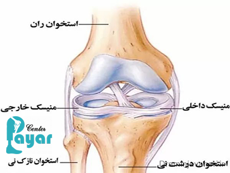 ایا پیاده روی برای پارگی مینیسک زانو ضرر دارد؟به چه علت؟