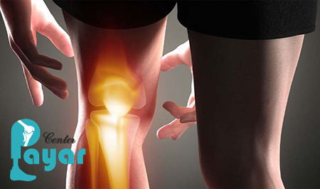 علائم پارگی رباط صلیبی