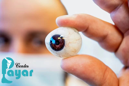 چرا برای ساخت پروتز چشم به پایار برویم؟