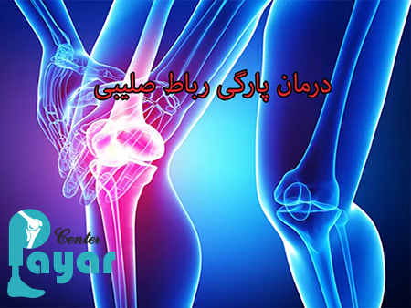 ایا با رباط صلیبی پاره میتوان راه رفت و روش های درمان