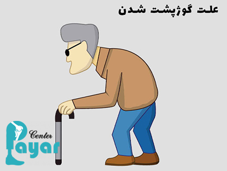 آیا می دانید علت کیفوز چیست