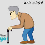 علت کیفوز چیست؟ بررسی علائم کیفوز