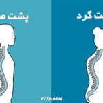 چگونه قوز کمر رو از بین ببریم؟ درمان خانگی با 9 حرکت