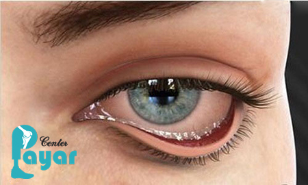 در مورد چالش های ساخت پروتز چشم چه می دانید؟