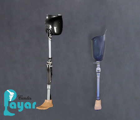 پای مصنوعی از لگن با پروتز پا بالای زانو چه تفاوتی دارد؟