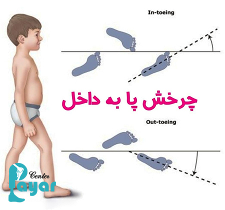 حرکات اصلاحی چرخش مچ پا به داخل