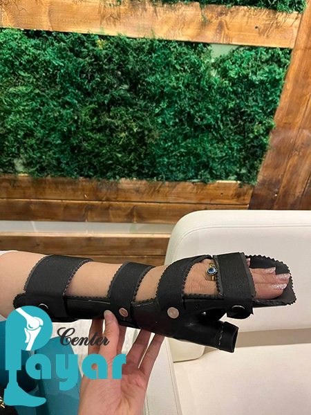 نمونه ارتز دست کلینیک پایار