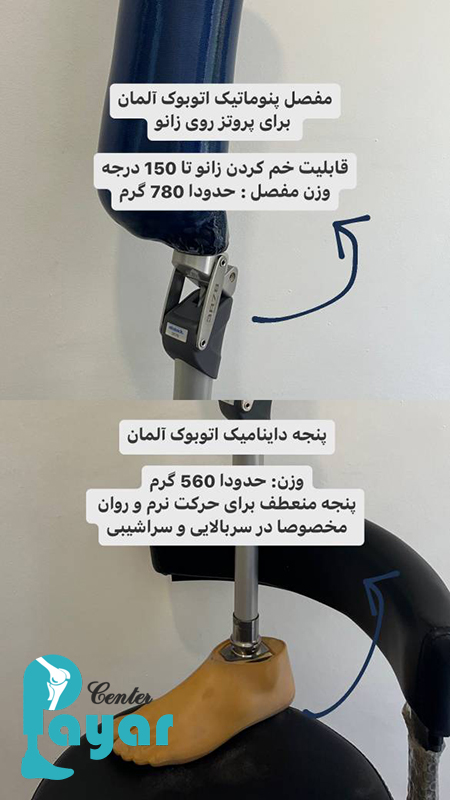 پروتز بالای زانو در پایار