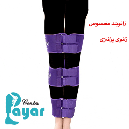 زانو بند برای زانوی پرانتزی
