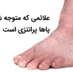 نحوه تشخیص زانوی پرانتزی چگونه است؟⭐آن را جدی بگیرید