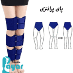 درمان پای پرانتزی چقدر طول میکشد؟⭐آن را جدی بگیرید