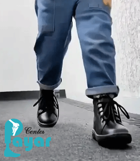 قیمت کفش طبی پنجه برعکس