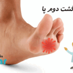 درد انگشت دوم پا نشانه چیست؟⭐آن را جدی بگیرید