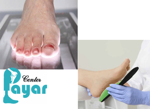 مزیت های ساخت کفی طبی با اسکن پا