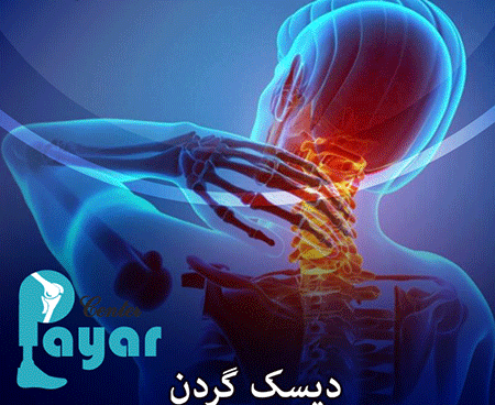 آیا می دانید چه کارهایی برای دیسک گردن ضرر دارد