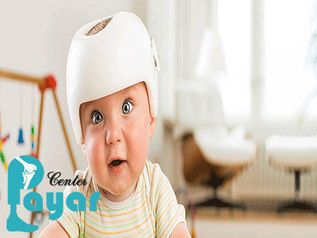 در مورد نحوه استفاده از کلاه فرم دهی سر نوزاد چه می دانید