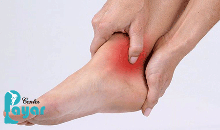 پیچ خوردگی مچ پا چیست