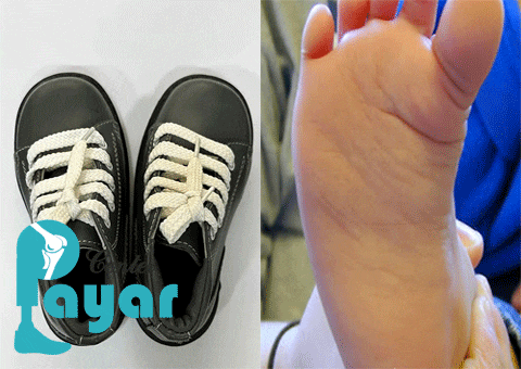 قیمتساخت کفش طبی پنجه برعکس چند است؟