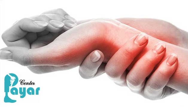 آیا سندرم تونل کارپال خطرناک است؟ آن را جدی بگیرید