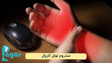 آیا سندرم تونل کارپال خطرناک است؟ در این رابطه چه میدانید