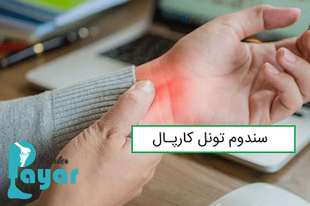 آیا می دانید سندروم تونل کارپال چیست