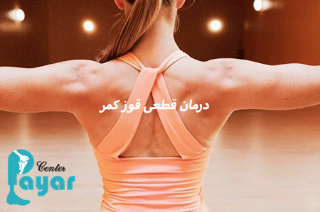 درمان قطعی قوز کمر چیست؟