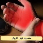 آیا سندرم تونل کارپال خطرناک است؟🌟آن را جدی بگیرید!