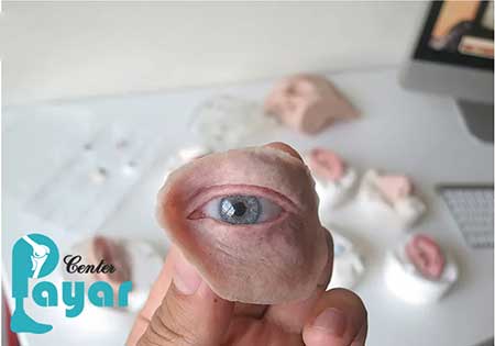 علائم و نشانه های تجدید ساخت پروتز چشم مصنوعی