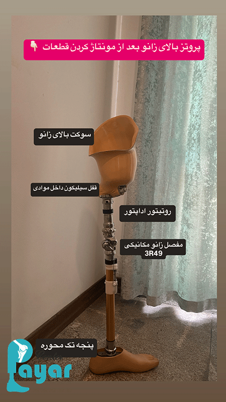پروتز بالای زانو بعد از مونتاژ کردن قطعات