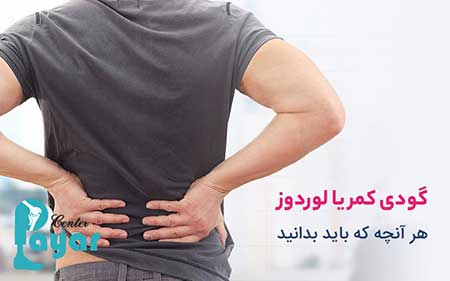 لوردوز چیست