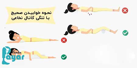 چگونگی نحوه خوابیدن تنگی کانال نخاعی