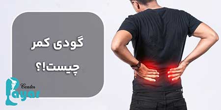 گودی کمر یا لوردوز چیست